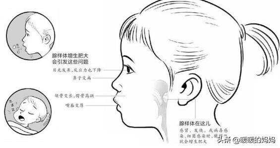 兒子越長越像“大猩猩”，媽媽疑惑又擔心，醫生責問：咋不早點來